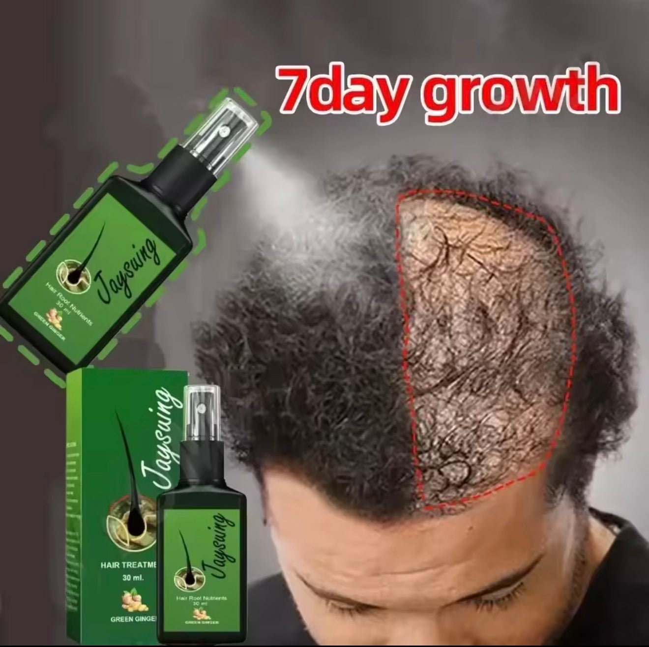 Fast Hair Growth Serum Spray Anti Hair Loss Prevent Baldness Scalp Treatment Repair Roots Beauty Health Hair Care For Men Women