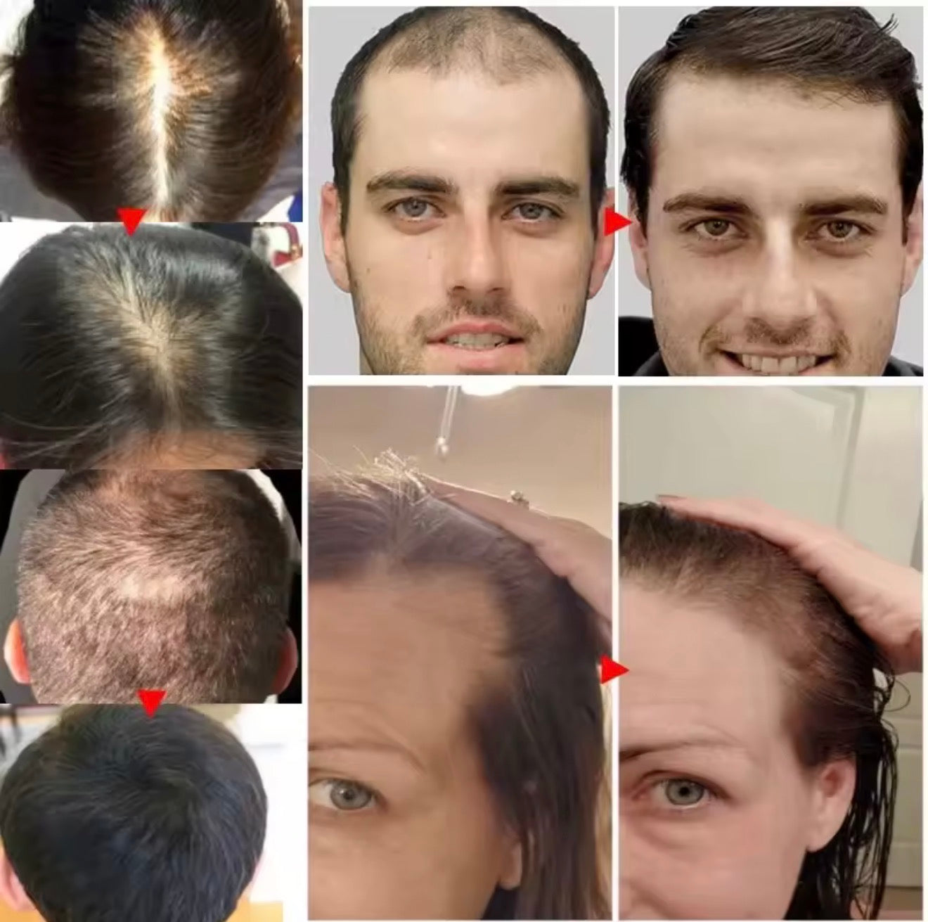 Fast Hair Growth Serum Spray Anti Hair Loss Prevent Baldness Scalp Treatment Repair Roots Beauty Health Hair Care For Men Women