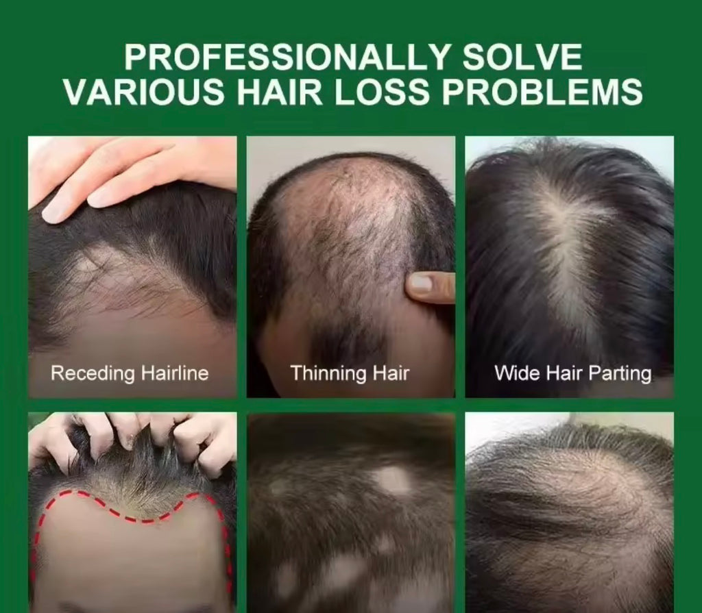 Fast Hair Growth Serum Spray Anti Hair Loss Prevent Baldness Scalp Treatment Repair Roots Beauty Health Hair Care For Men Women