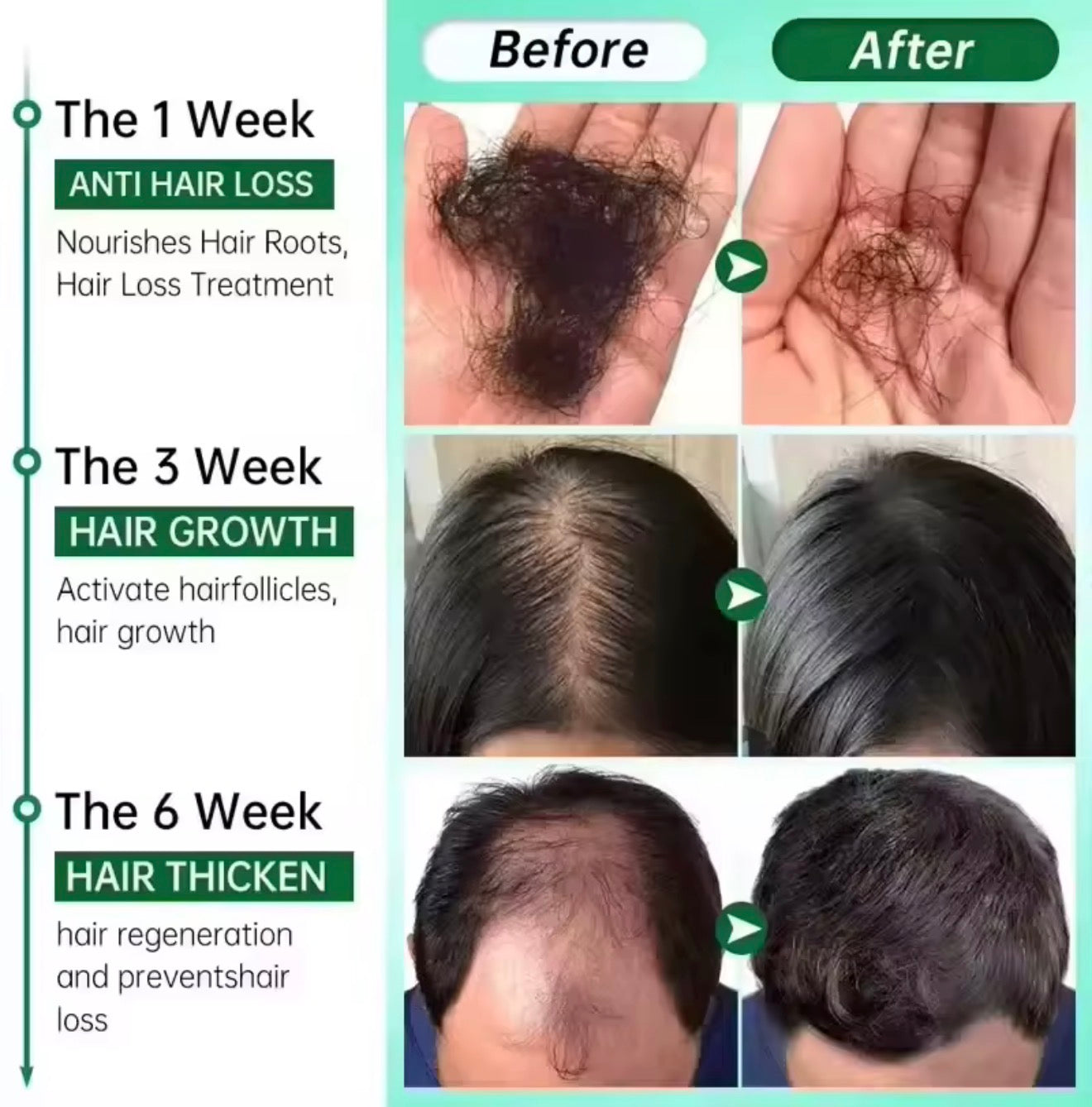 Fast Hair Growth Serum Spray Anti Hair Loss Prevent Baldness Scalp Treatment Repair Roots Beauty Health Hair Care For Men Women